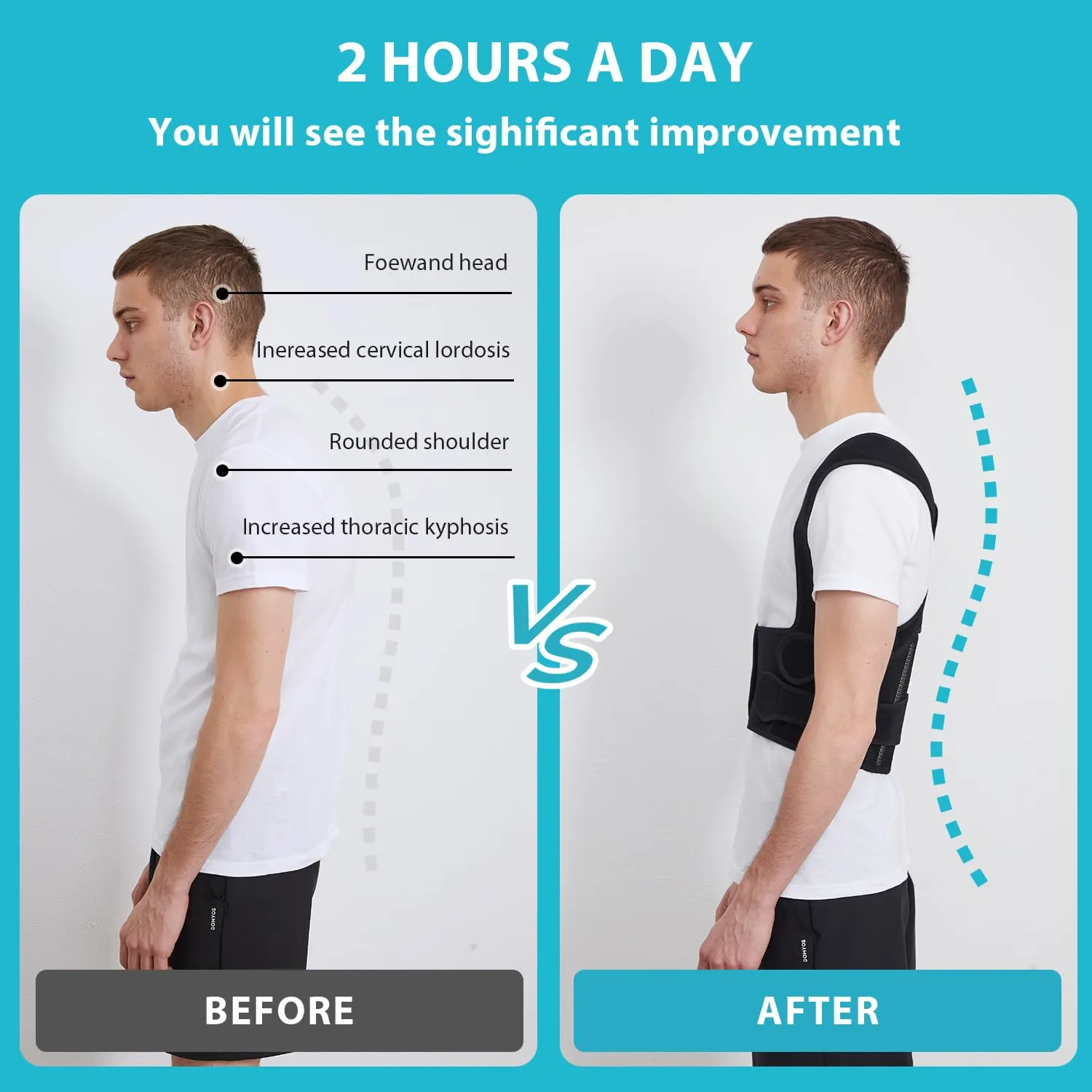 KD Back Brace Posture Corrector - Full Support for Women and Men - Straighten Shoulders, Relieve Upper and Lower Back Pain - Ideal for Scoliosis, Hunchback, Hump, Thoracic Issues (X-Large)